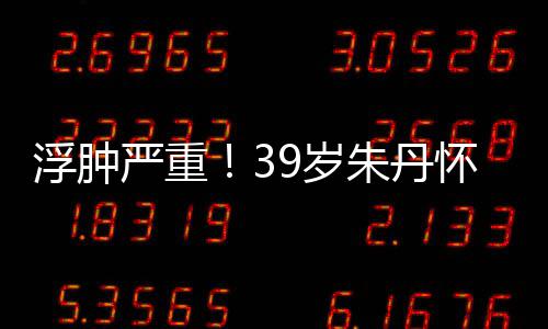 严重月 朱丹直播带货怀孕7个坚持浮肿9岁深夜